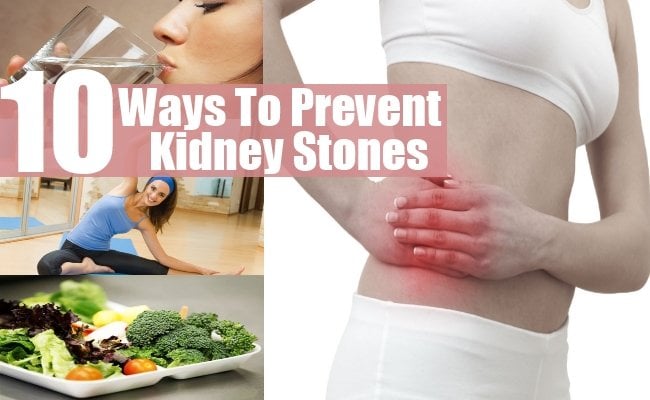 10 Best And Effective Ways For Kidney Stones Prevention ...