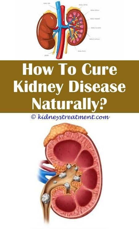 10 Warning Signs Of Kidney Failure