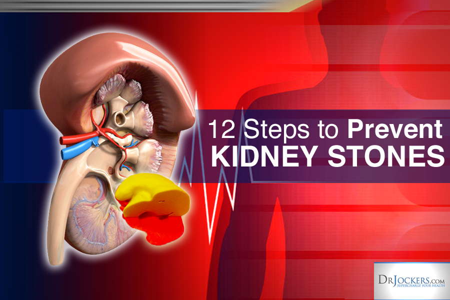 12 Key Steps to Prevent Kidney Stones