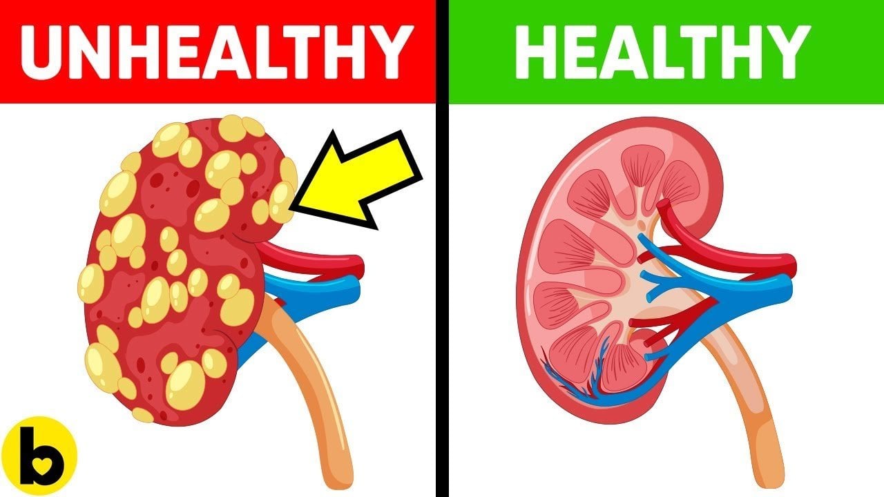 13 Foods That Make Your Kidneys Healthy