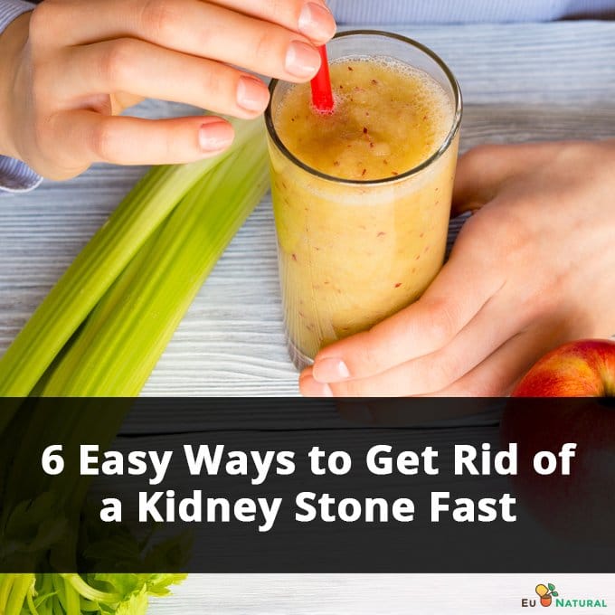 6 Easy Ways to Get Rid of a Kidney Stone Fast