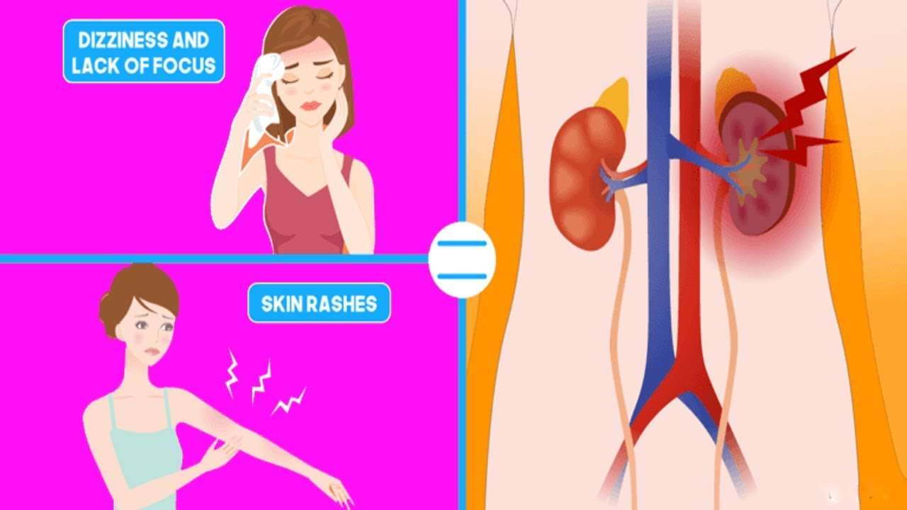 8 Alarming Signs That Your Kidneys Are Shutting Down