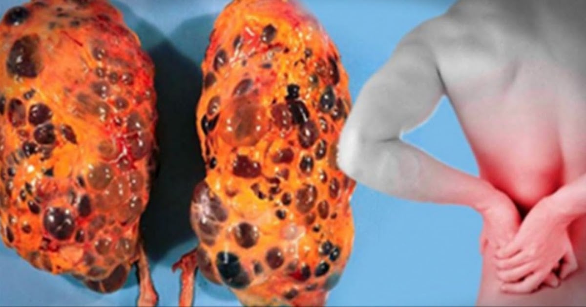 8 BAD HABITS ARE DESTROYING YOUR KIDNEYS EVERY DAY ...