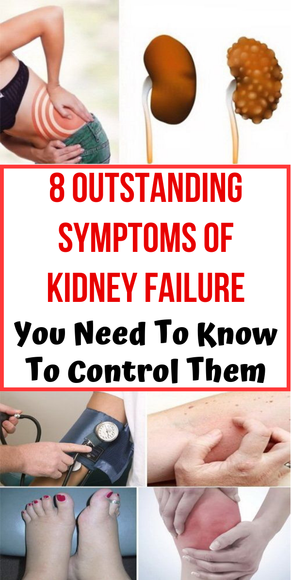 8 Outstanding Symptoms Of Kidney Failure You Need To Know ...