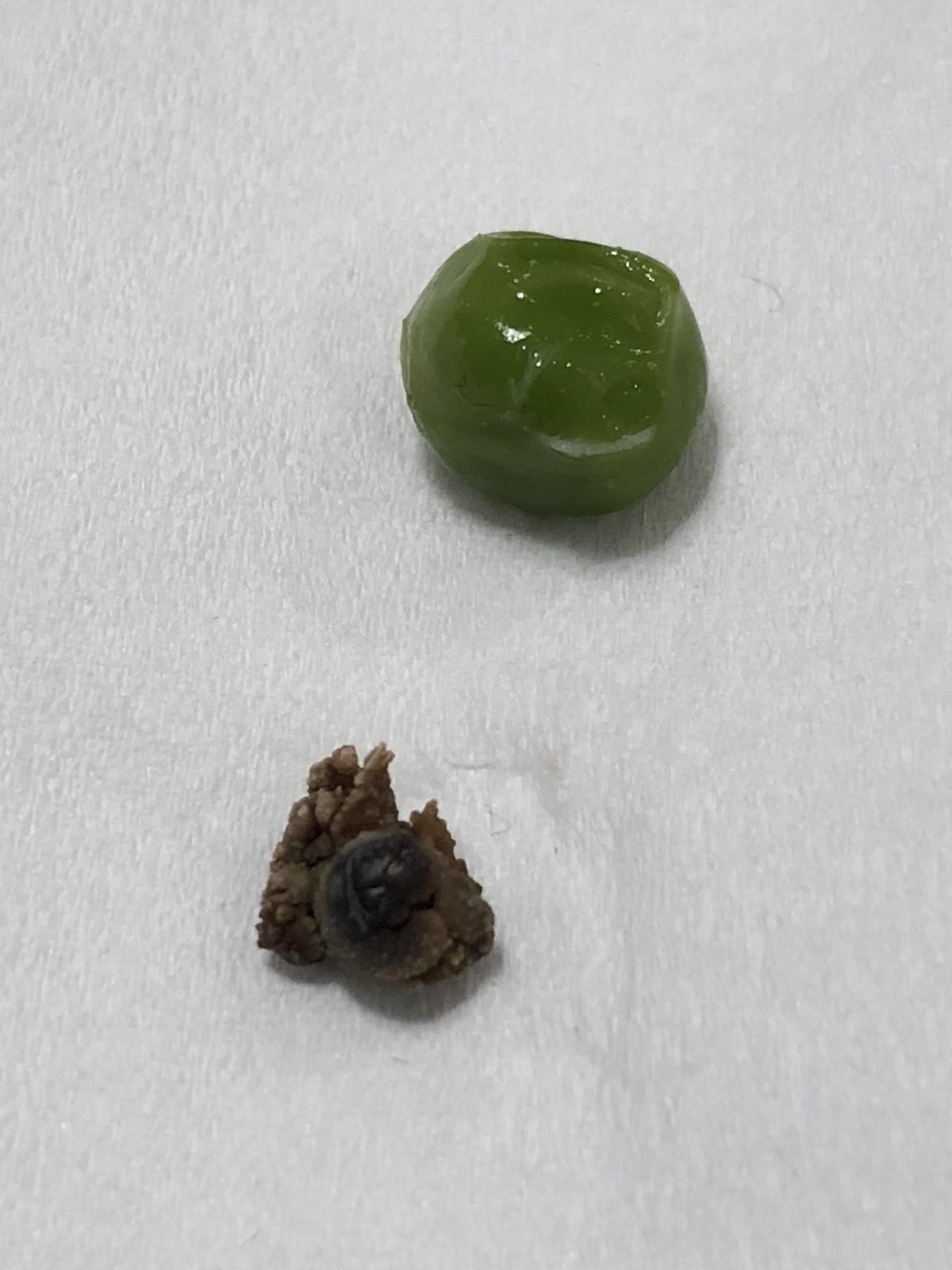 8mm Kidney Stone I passed this morning : mildlyinteresting