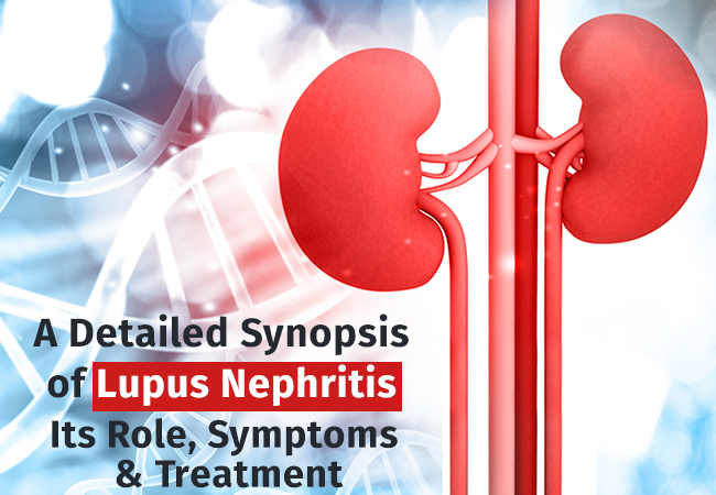 A Detailed Synopsis of Lupus Nephritis  Its Role, Symptoms &  Treatment ...