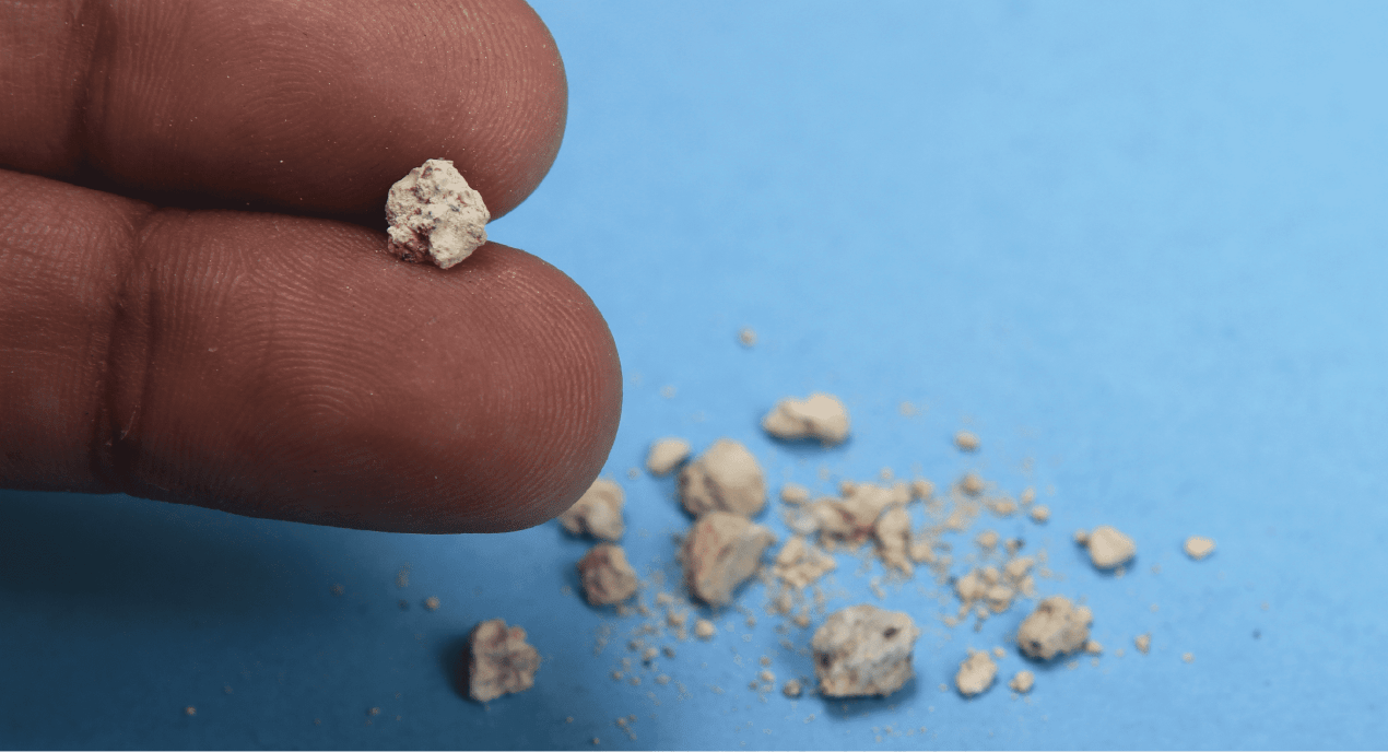 A TCM Physician Reveals How Kidney Stones Can Be Treated ...
