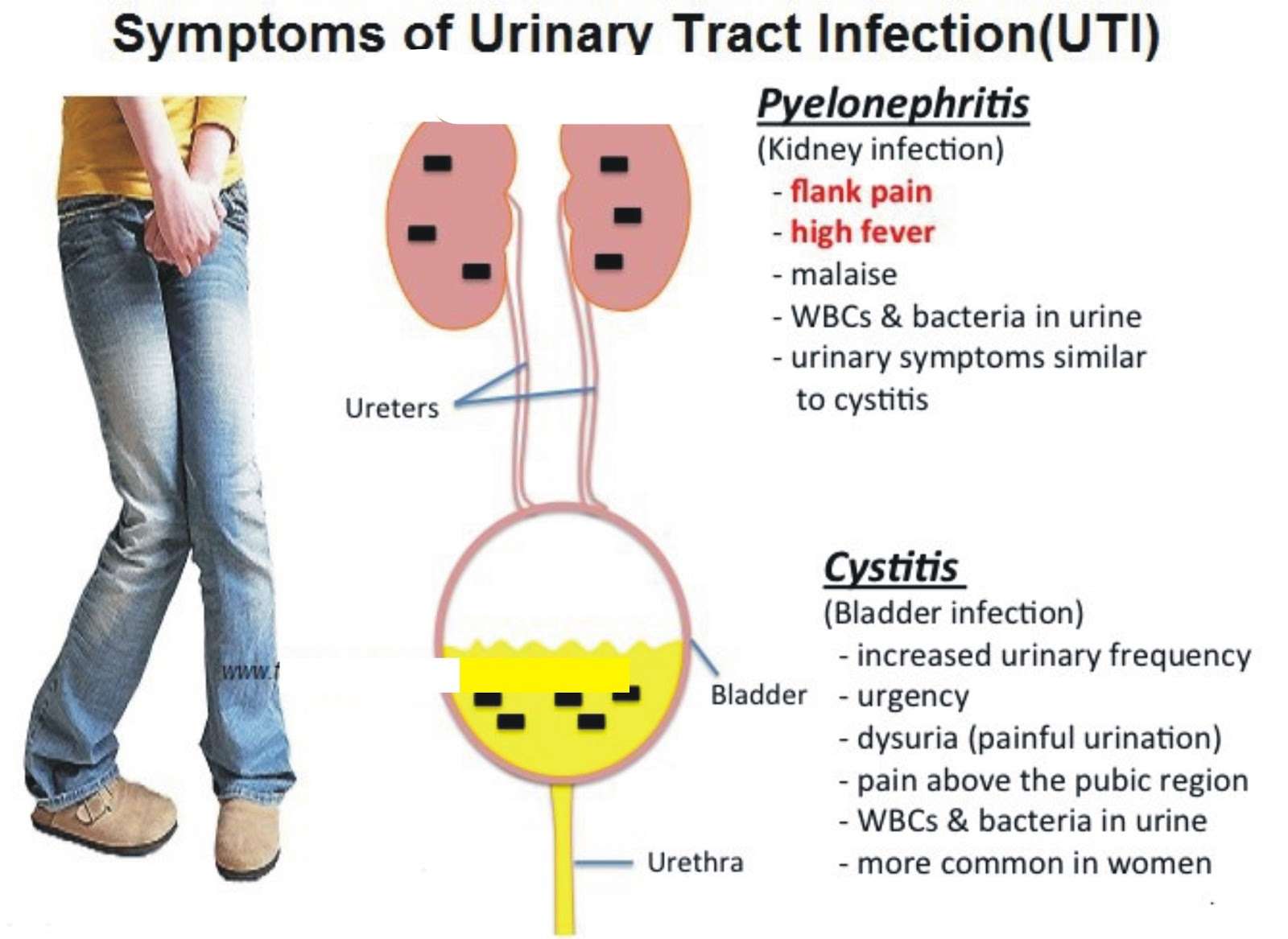 A Urinary Tract Infection Overview