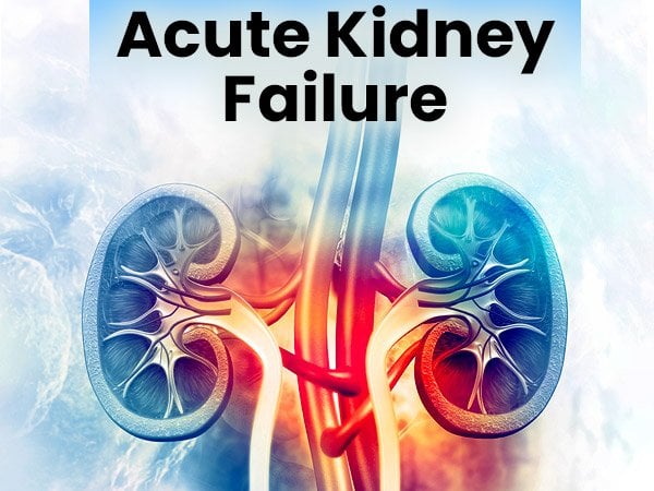 Acute Kidney Injury (Acute Kidney Failure): Causes ...