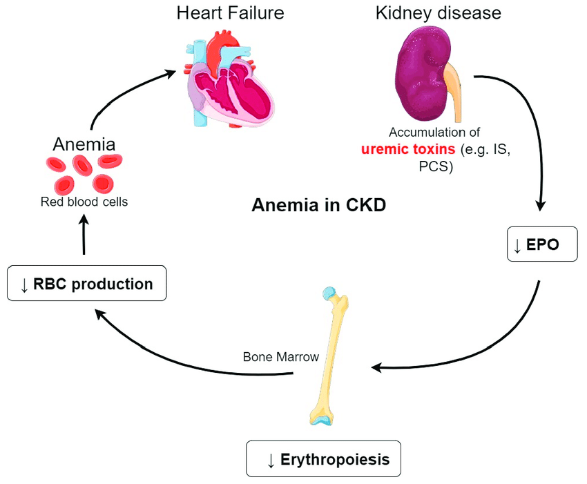 Anemia in CKD. Accumulation of uremic toxins induces a ...