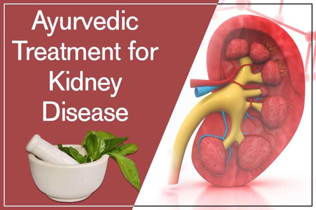 Apply Ayurveda treatment and Stop kidney transplant easily
