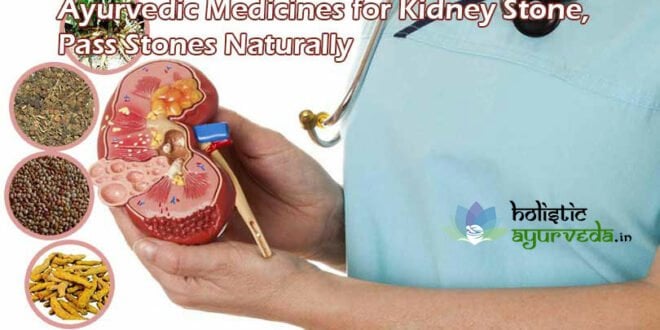 Ayurvedic Medicines for Kidney Stone, Pass Stones Naturally