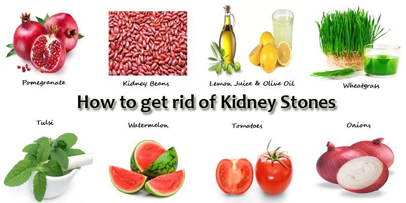 Best 10 Home Remedies for Kidney Stones