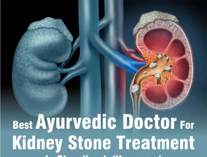 Best Ayurvedic Doctor For Kidney Stone Treatment in ...