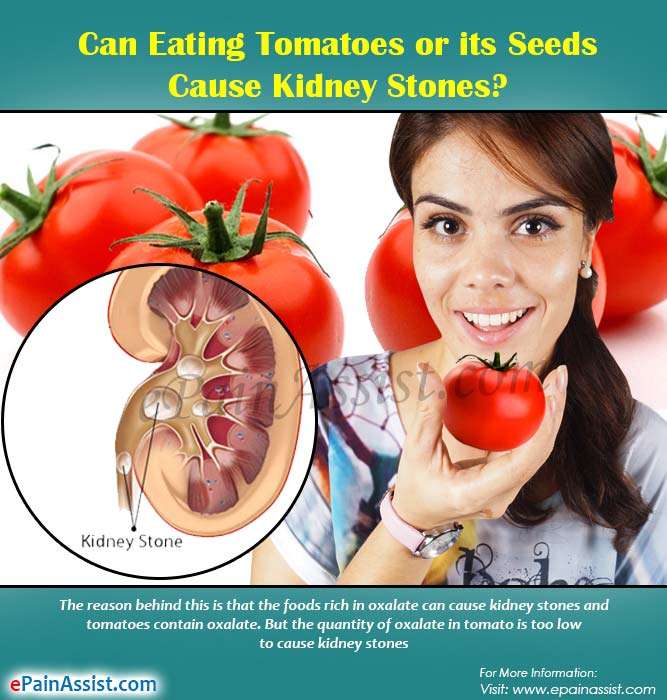 Can Eating Tomatoes or its Seeds Cause Kidney Stones?