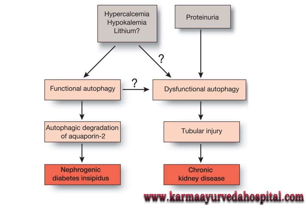 Can Kidney Function Restored After Dialysis? Karma ...