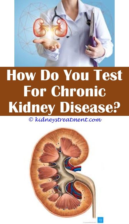 Can Kidney Stones Cause Chronic Diarrhea