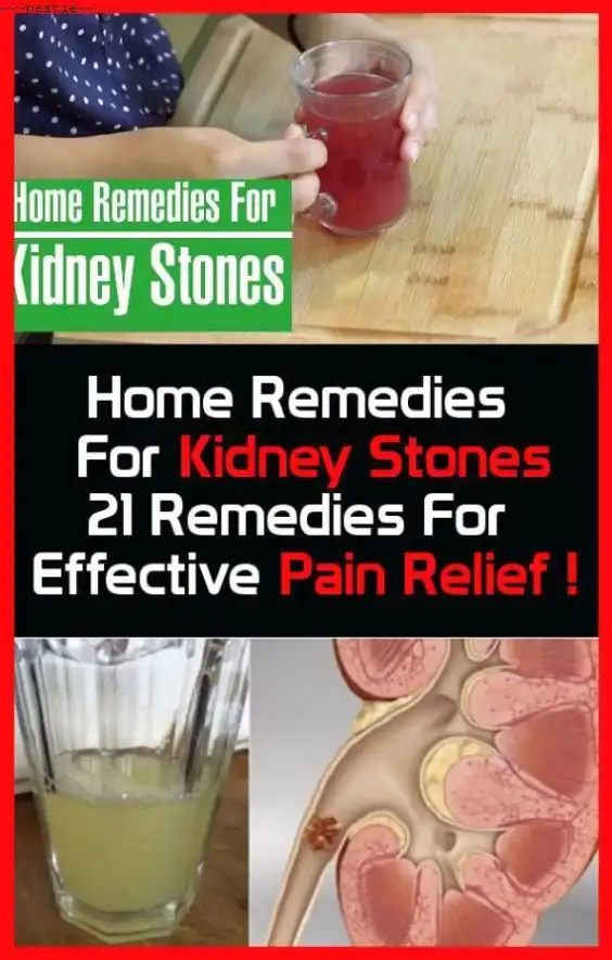 Can Seltzer Water Cause Kidney Stones