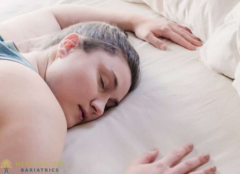 Can Sleep Apnea Be Treated by Bariatric Surgery? Los ...