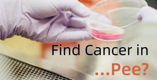 Cancer Can Be Detected in Urine?