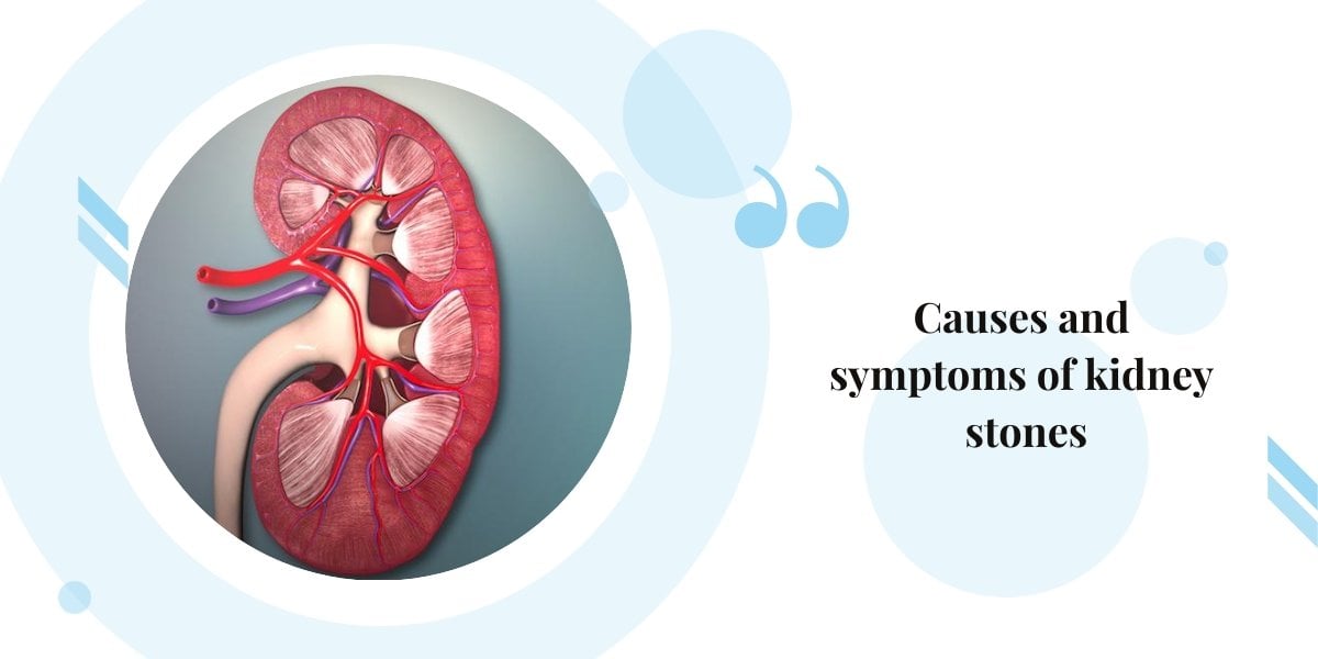 Causes and symptoms of kidney stone