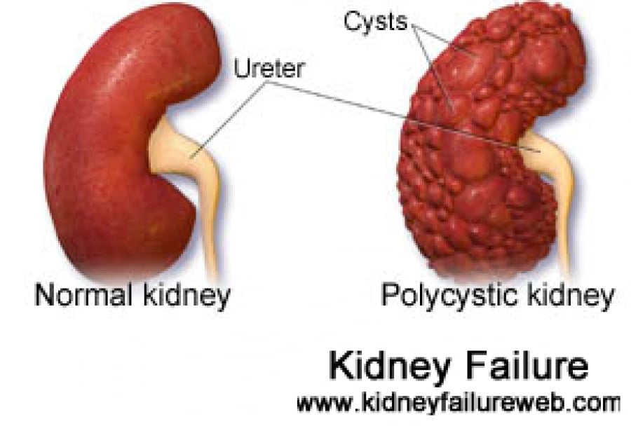Common causes of Kidney Failure with Signs: Pg2(Photos ...