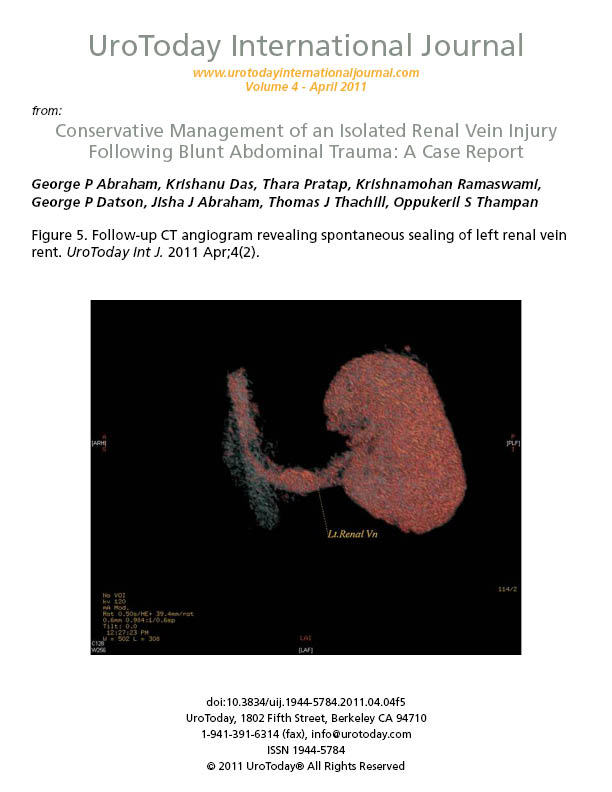 Conservative Management of an Isolated Renal Vein Injury ...