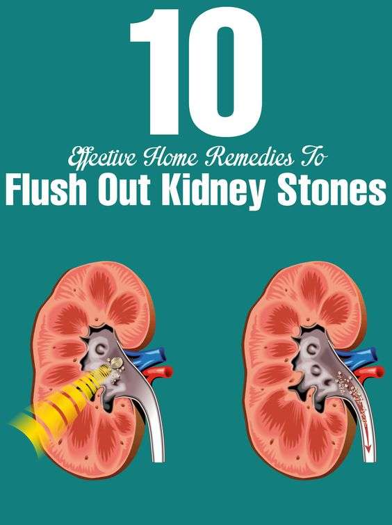Cure Kidney Stone Naturally