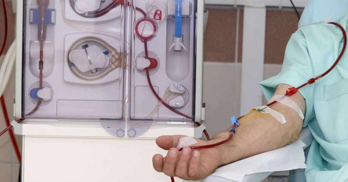 Dialysis: Procedure, purpose, types, side effects, and more
