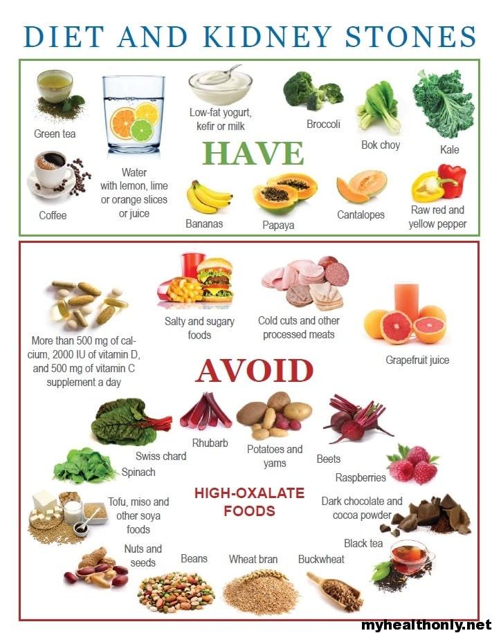 Diet for Kidney Stones: What not to eat in kidney stones ...