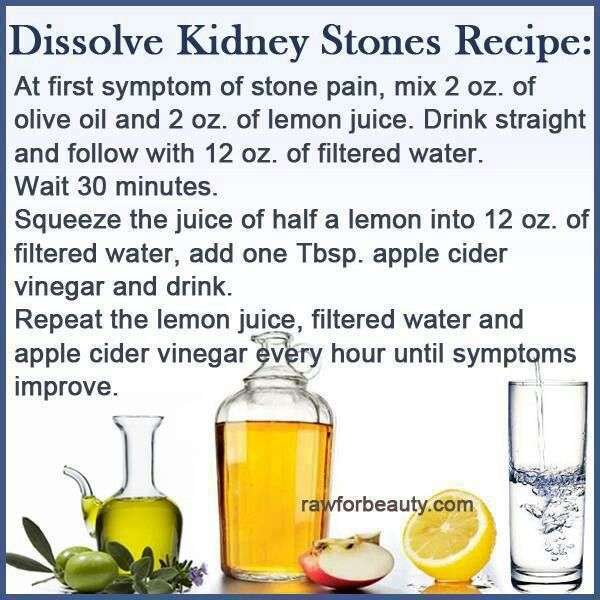 Dissolving kidney stones