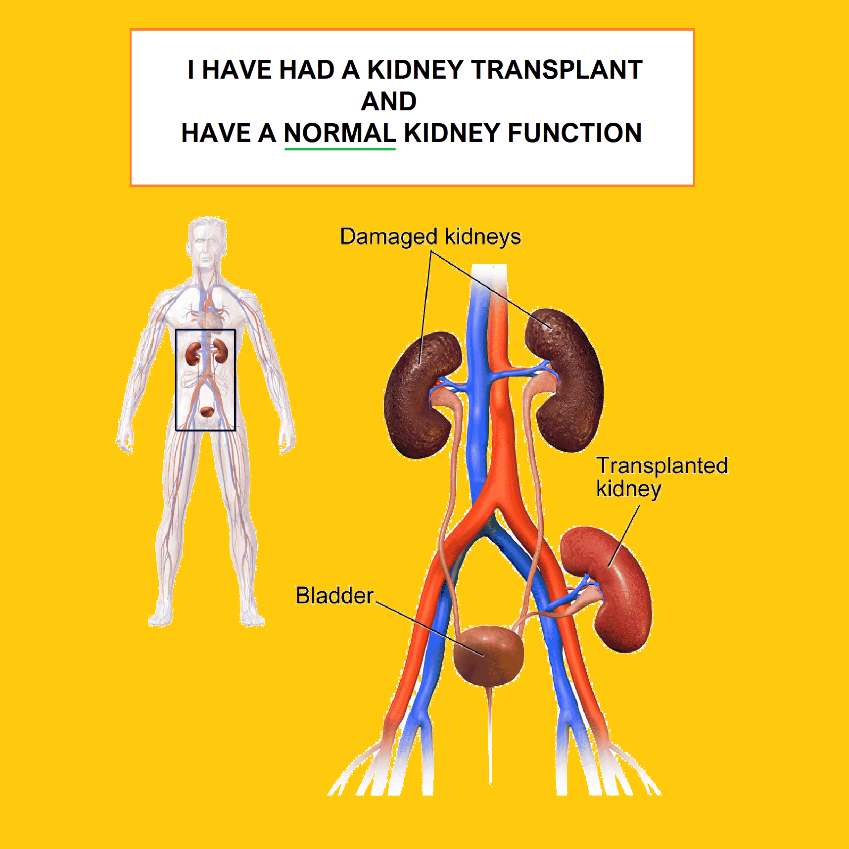 Do Whey Protein Supplements Harm Kidneys?