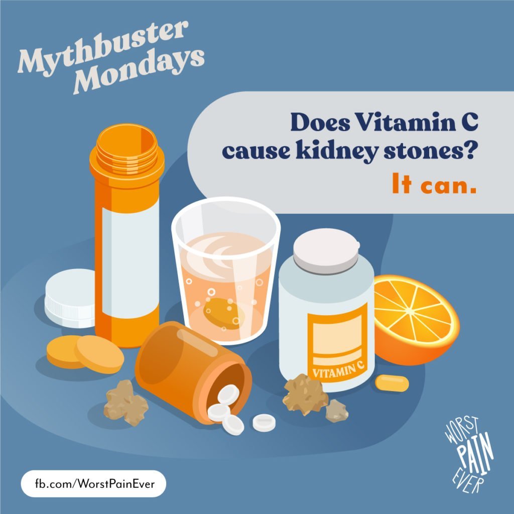 Does Vitamin C cause kidney stones? It can.