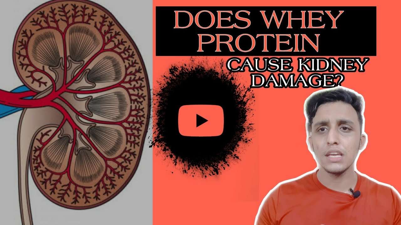 DOES WHEY PROTEIN CAUSE KIDNEY DAMAGE?