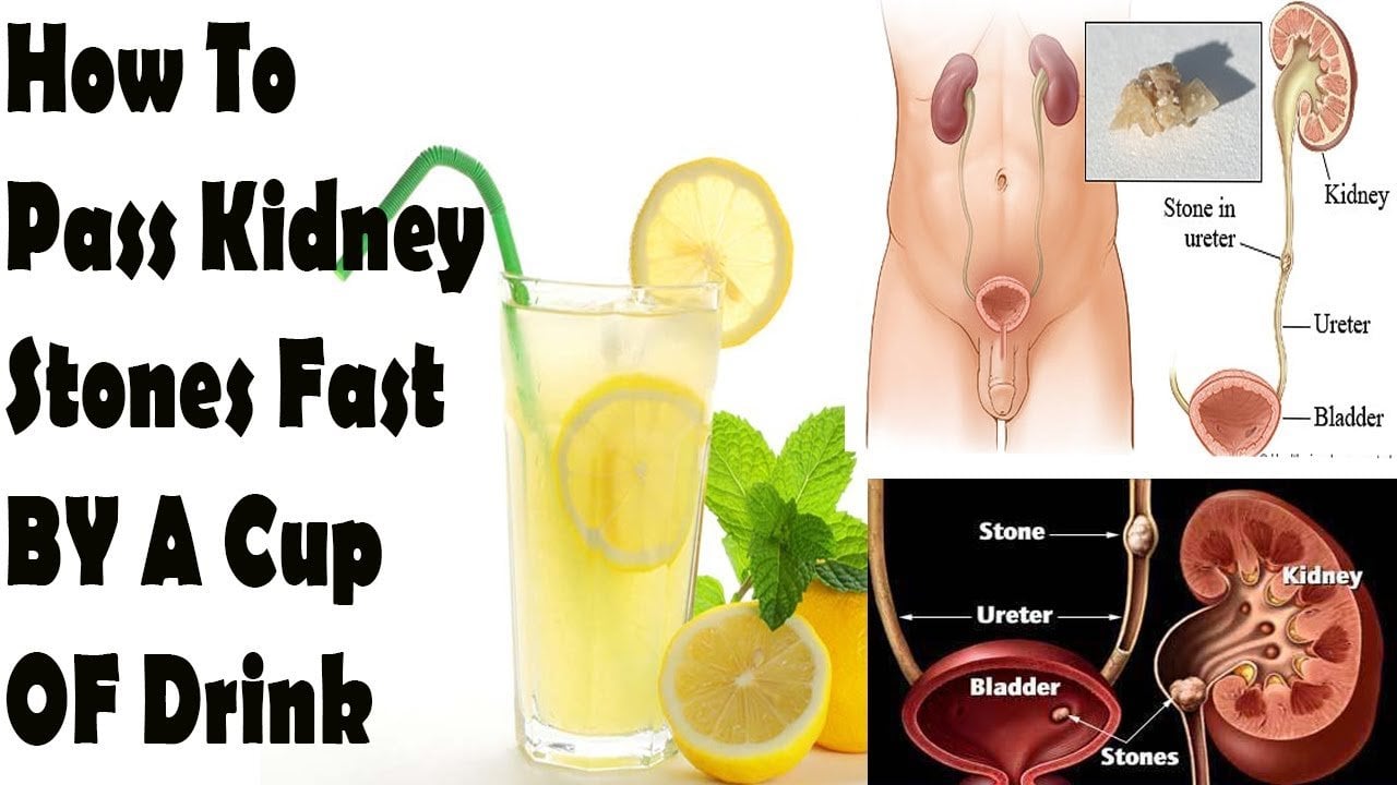 Drink A Cup This Juice And Say Goodbye To Your Kidney ...
