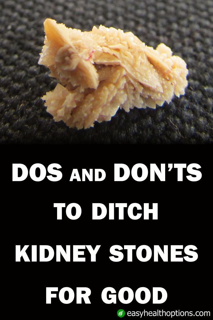 Easy Health Options® :: Dos and donts to ditch kidney ...