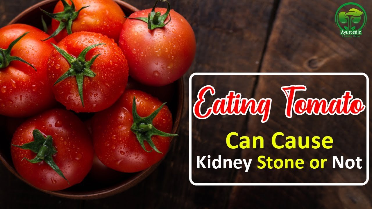 Eating Tomato Causes Kidney Stone Or Not