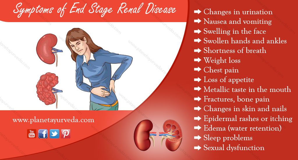 End Stage Renal Disease : Causes, Symptoms, And Home ...