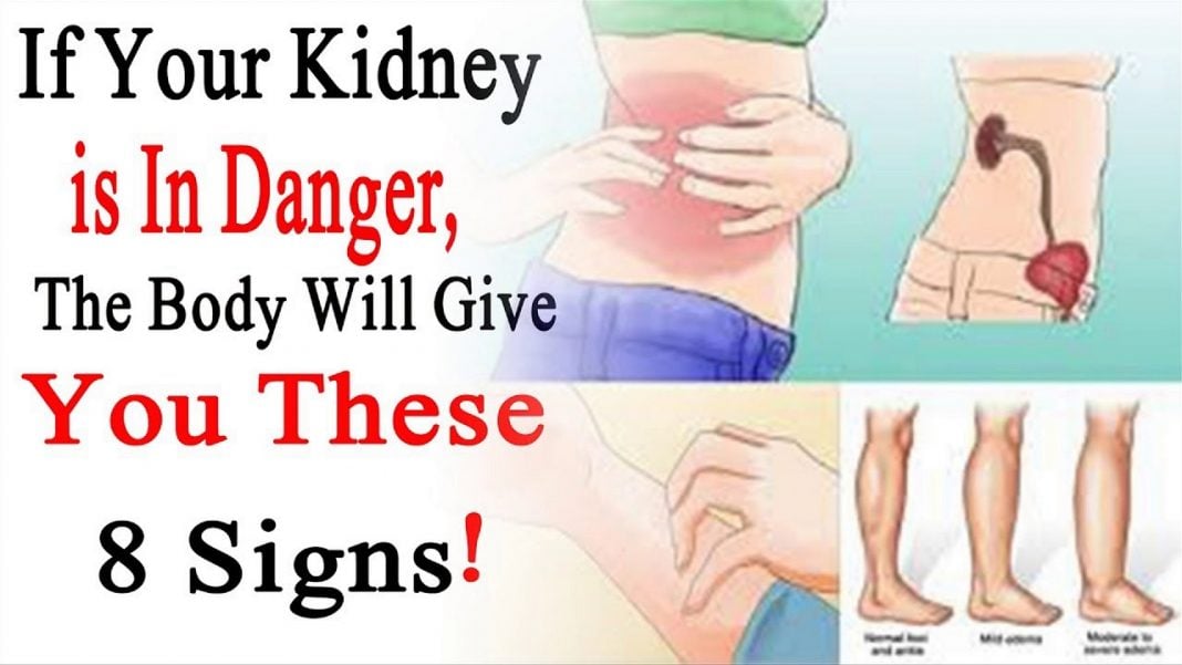 how-to-tell-kidney-pain-from-back-pain