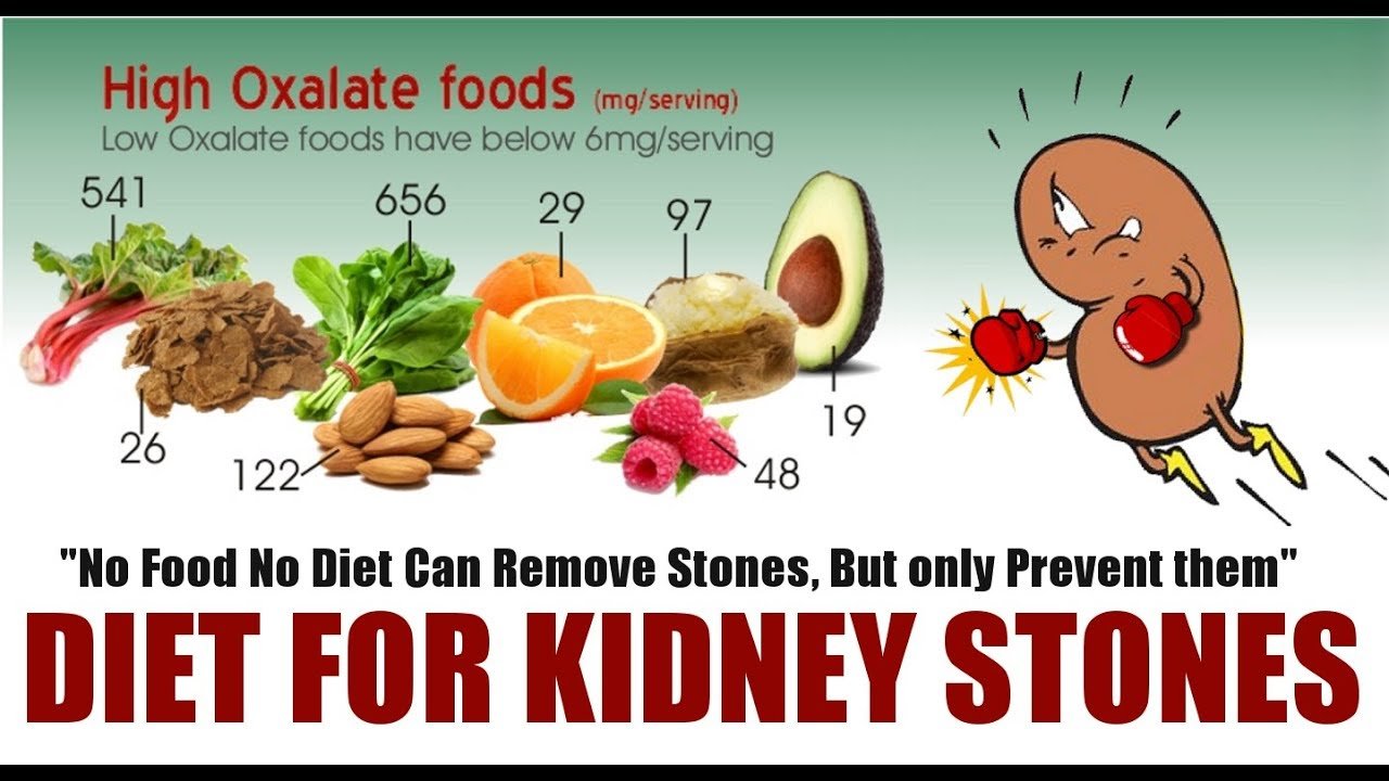 Foods To Avoid For Kidney Stones