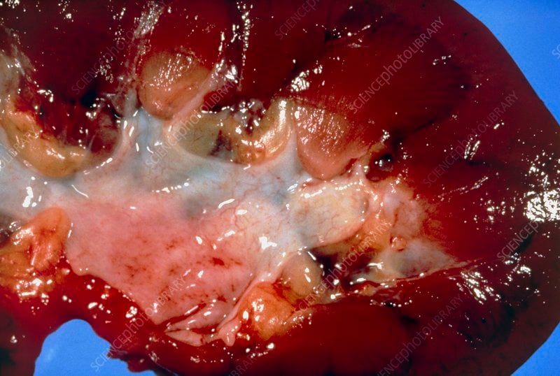 Gross specimen of normal human kidney in section