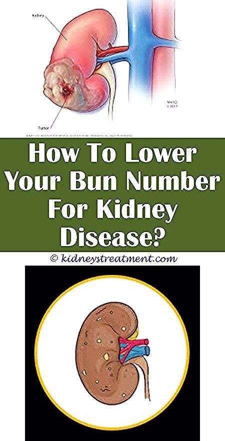 Here Are 10 Warning Signs Your Kidneys Are Not Working Properly, Do Not ...