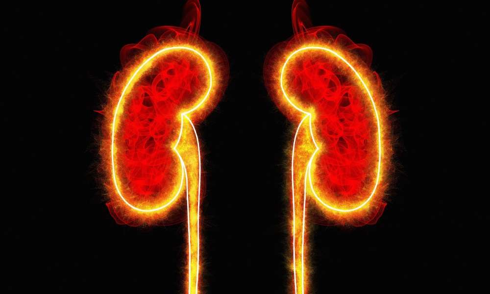 High Uric Acid Ups Renal Failure Risk in Some CKD Patients