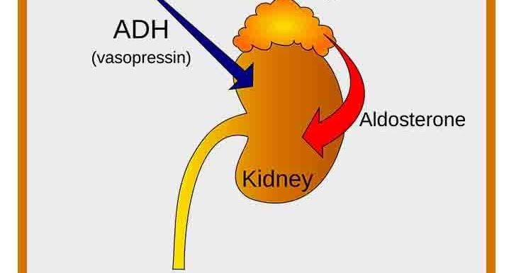 Home Remedies to Get Rid Of a Kidney Infection ~ Health ...