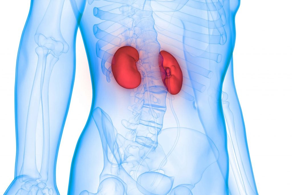 How does obesity affect kidney transplant success?