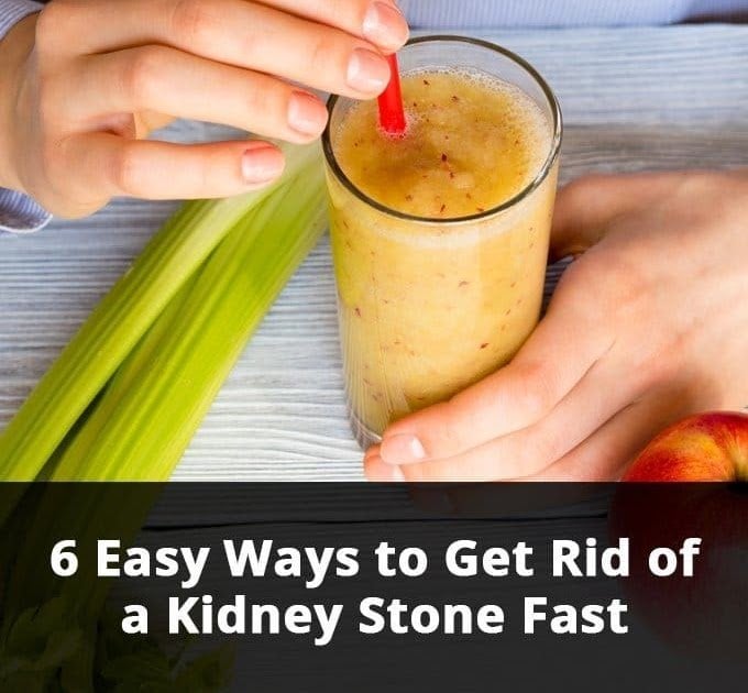 How Much Water Should We Drink To Remove Kidney Stones