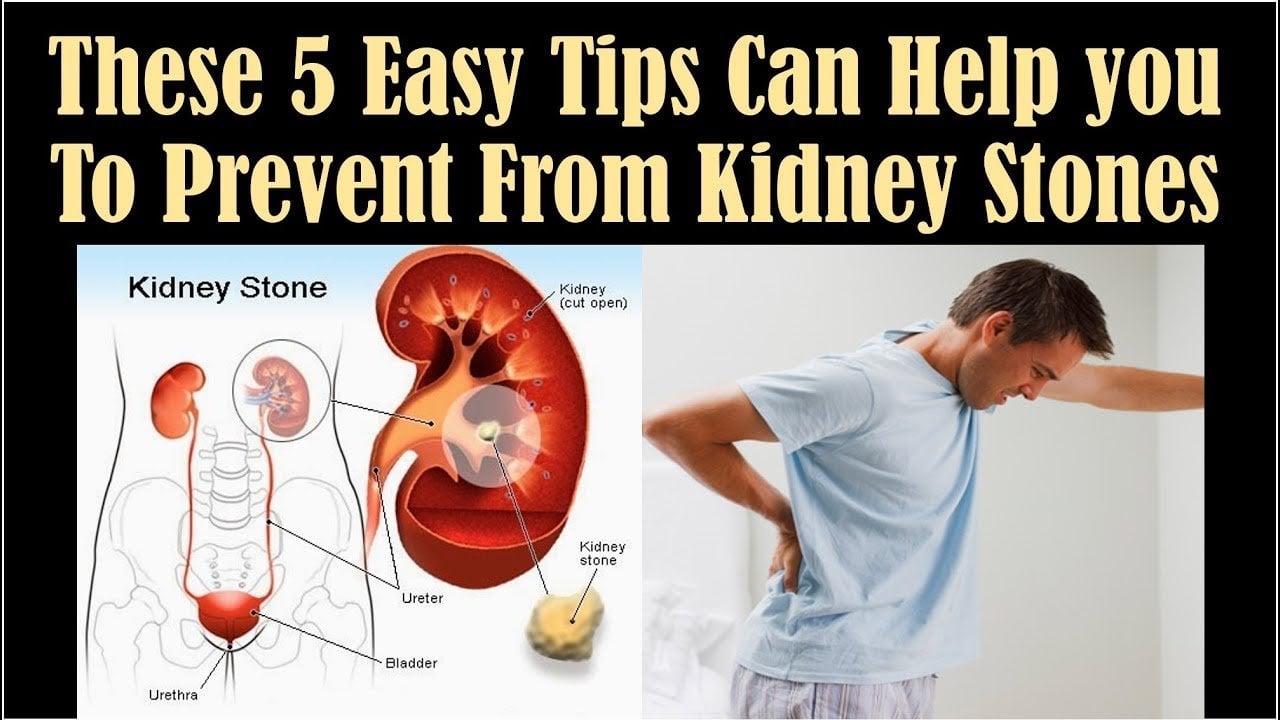How To Get Rid From Kidney Stones