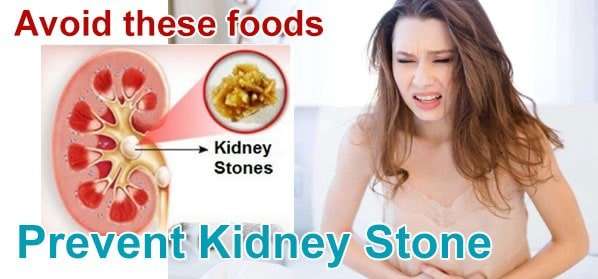 How to get rid of kidney stones in a day?