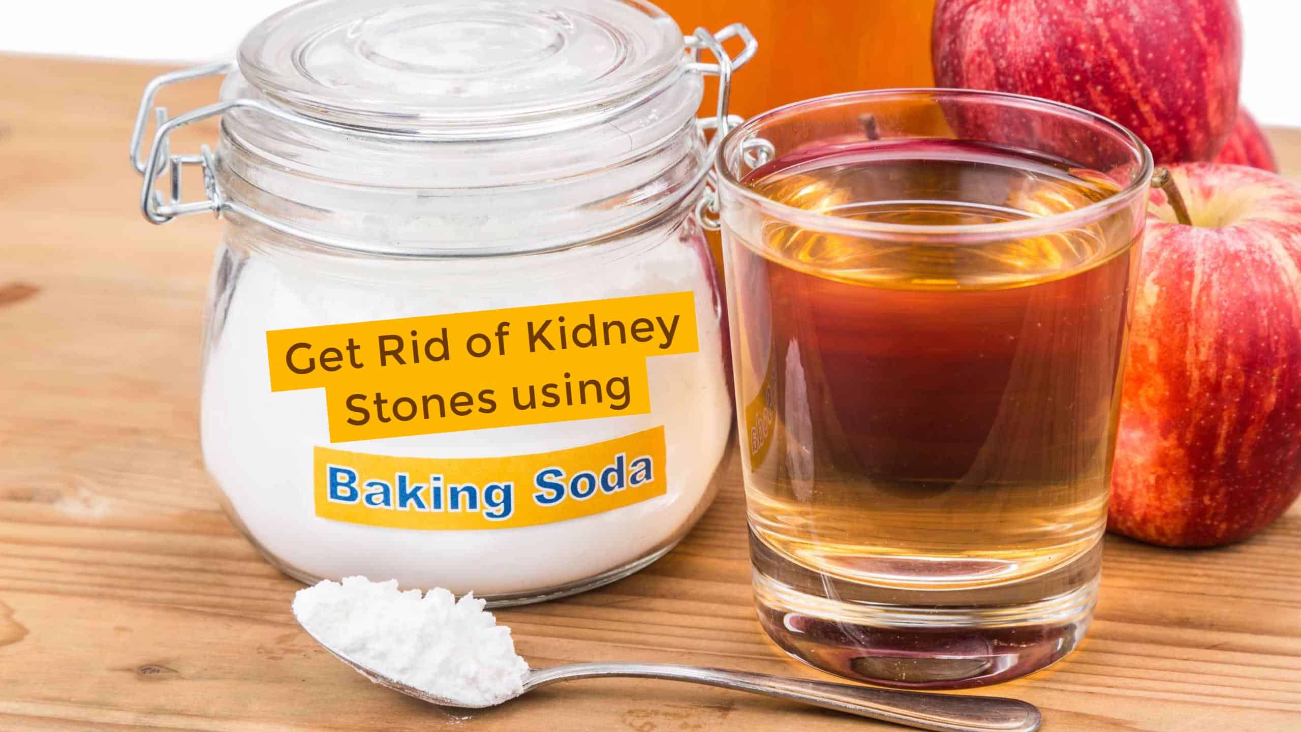 How to Get Rid of Kidney Stones using Baking Soda