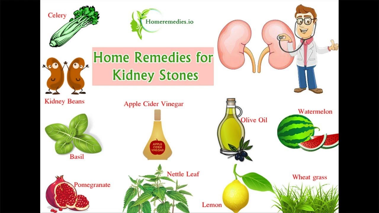 How to pass a kidney stone fast